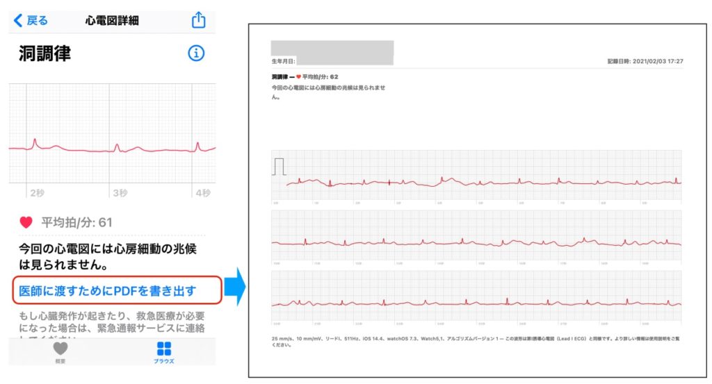 Apple Watchの日本で有効化された心電図機能の使い方